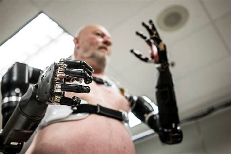 Bionic Human Betsul