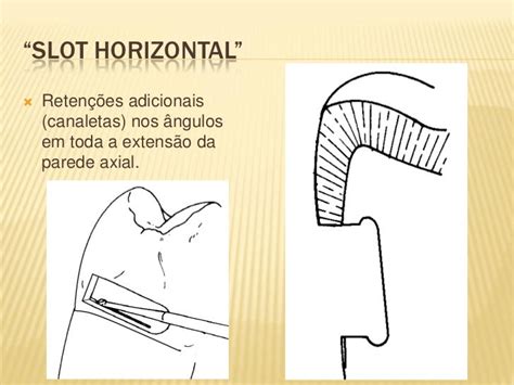 Slot Horizontal Dentistica